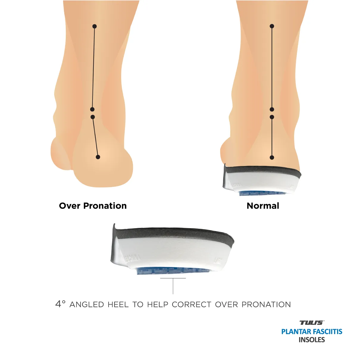 TULI'S PLANTAR FASCIITIS INSOLES - SAVE 10%